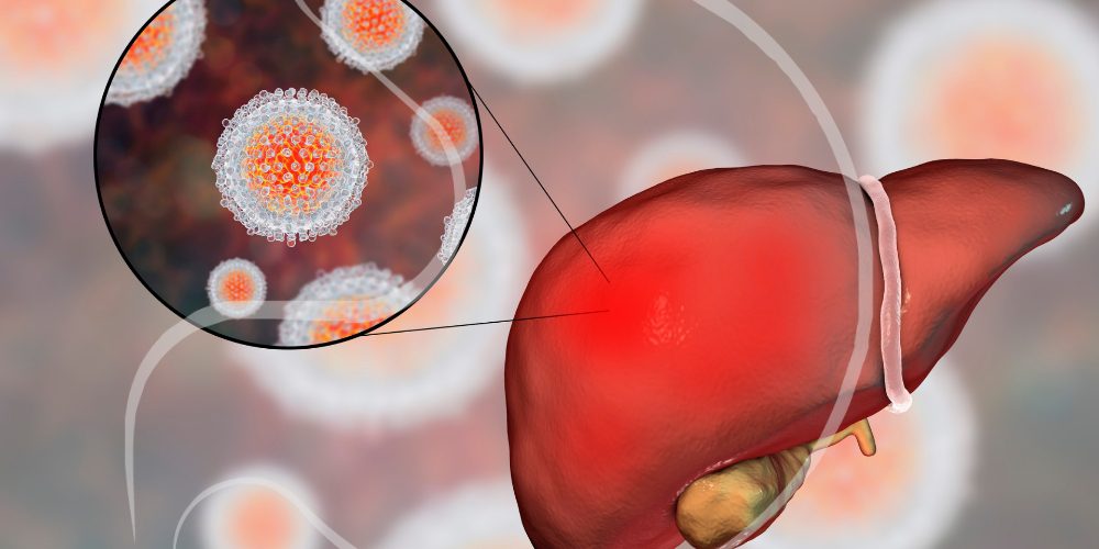 Doenças Autoimunes Hepáticas